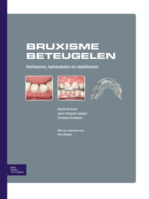 cover image of Bruxisme beteugelen